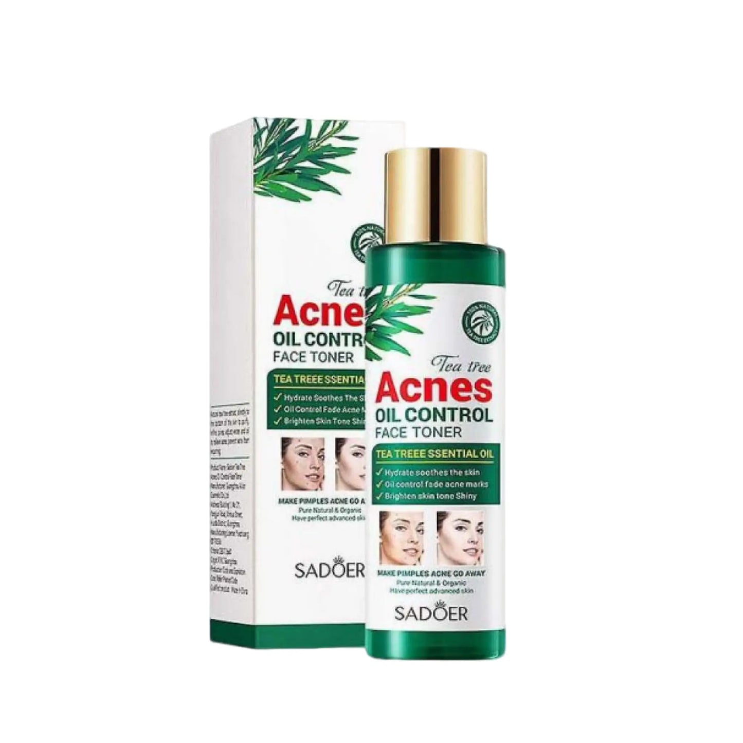 Tónico Facial Control de Grasa ACNES con Aceite Esencial de Árbol de Té SADOER Set x6 - J&C Cosmetics